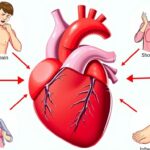 Gejala penyakit jantung